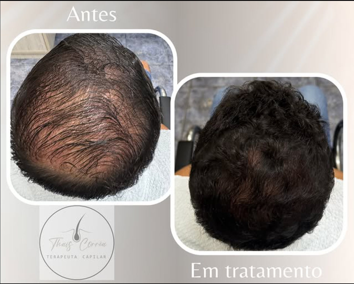 Antes e durante tratamento capilar Correttha